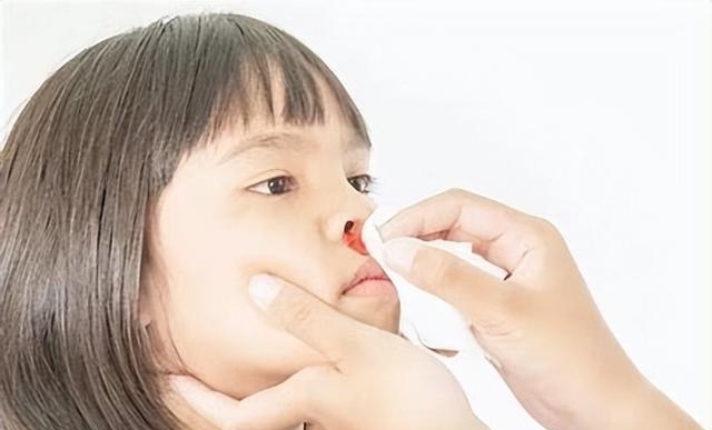 红霉素眼膏能消炎吗能外用吗，使用红霉素眼膏注意事项