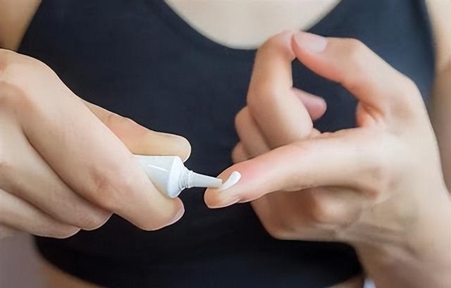 红霉素眼膏能消炎吗能外用吗，使用红霉素眼膏注意事项