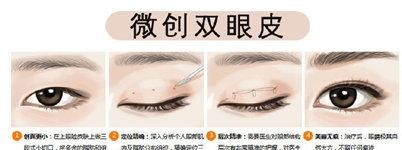 怎样练出双眼皮效果，眼皮变成双眼皮的四种方法