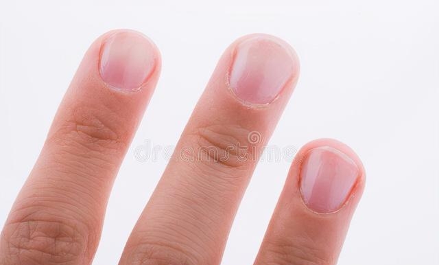 男性指甲发黄是什么原因造成的，指甲盖发黄的原因及解决办法
