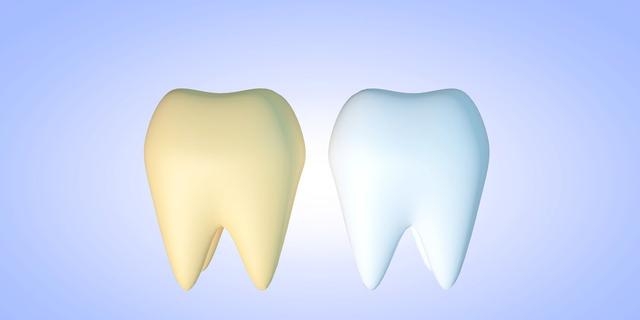 牙齿黄是什么原因引起，牙齿变色问题出在4方面