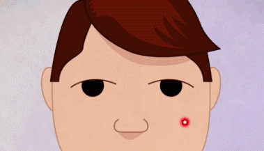 孩子脸上长痘痘如何消除，孩子长痘痘的12个原因