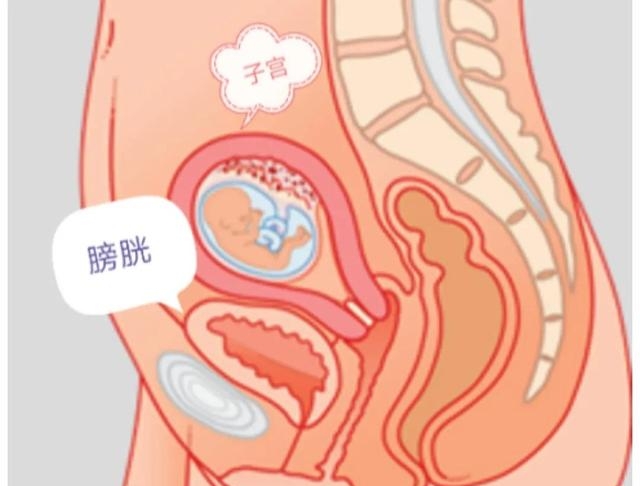 孕期漏尿是什么原因造成的，怀孕期间漏尿的原因