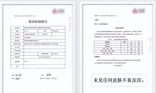 红色肥胖纹怎么去除，分享2个简单淡化肥胖纹的方法