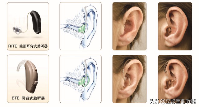 老人家的助听器怎么选，分享助听器验配的标准流程