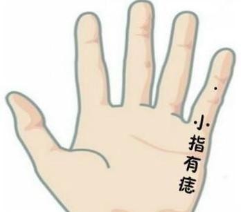 无名指上长了个痣代表什么意思，五根手指的桃花痣意义
