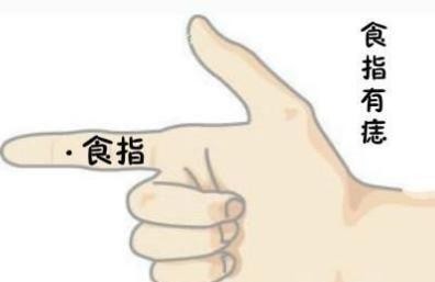 无名指上长了个痣代表什么意思，五根手指的桃花痣意义