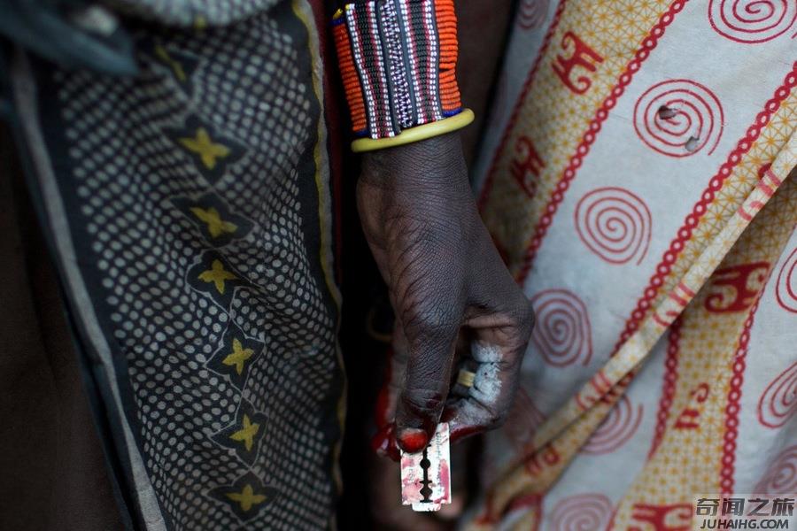 非洲的女孩割礼是怎样的,非洲割礼到底是割哪